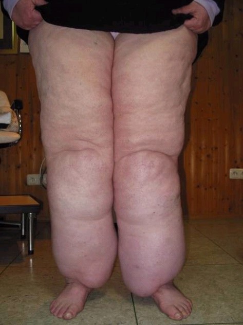 Las piernas más sexys del mundo&#8230;